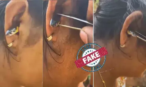 ചെവിയില് പാമ്പ് : പ്രചരിക്കുന്ന വീഡിയോയുടെ യാഥാര്ത്ഥ്യമെന്ത് ചെവിയില് പാമ്പ് : പ്രചരിക്കുന്ന വീഡിയോയുടെ യാഥാര്ത്ഥ്യമെന്ത്