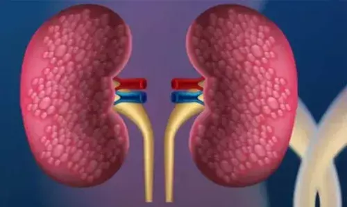 വൃക്കകളുടെ ആരോഗ്യം സംരക്ഷിക്കാന്‍ ഭക്ഷണത്തില്‍ ശ്രദ്ധിക്കേണ്ട കാര്യങ്ങള്‍ അറിയാം