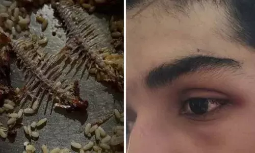 ഗൂഗിളില്‍ നെഗറ്റീവ് റിവ്യൂ നല്‍കിയതിന് എഞ്ചിനീയറിംഗ് വിദ്യാര്‍ത്ഥിക്ക് വീട്ടുടമയുടെ മര്‍ദനം