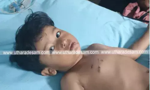 പാണത്തൂരില്‍ തെരുവ് നായയുടെ ആക്രമണം; കുട്ടികള്‍ ഉള്‍പ്പെടെ 5 പേര്‍ക്ക് പരിക്ക്