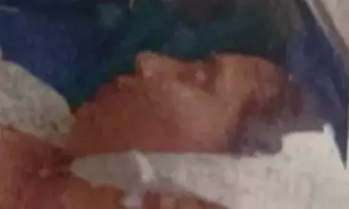 കാഞ്ഞങ്ങാട്ട് കോടതി മുറിയിലെ ഫാന്‍ പൊട്ടി ജീവനക്കാരിയുടെ തലയില്‍ വീണ് പരിക്ക്