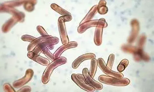 തിരുവനന്തപുരത്ത് കോളറ ബാധിച്ച് ഒരാള്‍ മരിച്ചു