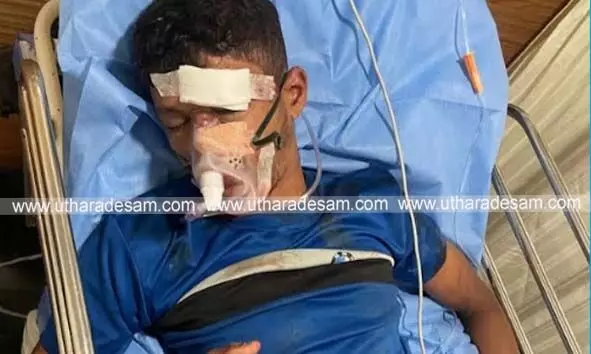 കുഞ്ചത്തൂരില് കര്ണ്ണാടക ട്രാന്സ് പോര്ട്ട് ബസില് നിന്ന് തെറിച്ചുവീണ് യാത്രക്കാരന് ഗുരുതരം; നാട്ടുകാര് ബസ് തടഞ്ഞു കുഞ്ചത്തൂരില് കര്ണ്ണാടക ട്രാന്സ് പോര്ട്ട് ബസില് നിന്ന് തെറിച്ചുവീണ് യാത്രക്കാരന് ഗുരുതരം; നാട്ടുകാര് ബസ് തടഞ്ഞു
