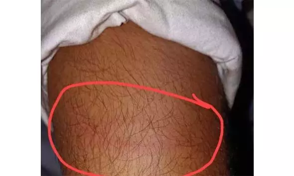 നാഷണല് ഹൈവേ കരാറുകാരനെ ട്രാഫിക് പൊലീസ് ഇന്സ്പെക്ടര് ലാത്തി കൊണ്ട് അടിച്ചതായി പരാതി നാഷണല് ഹൈവേ കരാറുകാരനെ ട്രാഫിക് പൊലീസ് ഇന്സ്പെക്ടര് ലാത്തി കൊണ്ട് അടിച്ചതായി പരാതി