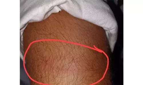 നാഷണല് ഹൈവേ കരാറുകാരനെ ട്രാഫിക് പൊലീസ് ഇന്സ്പെക്ടര് ലാത്തി കൊണ്ട് അടിച്ചതായി പരാതി നാഷണല് ഹൈവേ കരാറുകാരനെ ട്രാഫിക് പൊലീസ് ഇന്സ്പെക്ടര് ലാത്തി കൊണ്ട് അടിച്ചതായി പരാതി