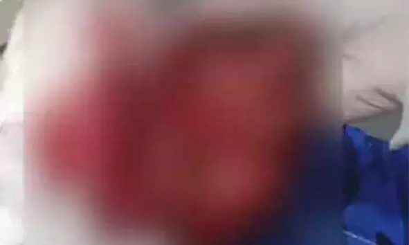 ബണ്ട്വാളില് യുവാവിന് കുത്തേറ്റു; പരിക്ക് ഗുരുതരം; പൊലീസ് അന്വേഷണം ആരംഭിച്ചു ബണ്ട്വാളില് യുവാവിന് കുത്തേറ്റു; പരിക്ക് ഗുരുതരം; പൊലീസ് അന്വേഷണം ആരംഭിച്ചു