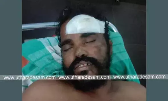 കാഞ്ഞങ്ങാട്ട് ട്രെയിനിനും പ്ലാറ്റ് ഫോമിനുമിടയില്‍പെട്ട് യാത്രക്കാരന്റെ കാല്‍പ്പാദമറ്റു