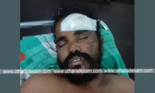 കാഞ്ഞങ്ങാട്ട് ട്രെയിനിനും പ്ലാറ്റ് ഫോമിനുമിടയില്പെട്ട് യാത്രക്കാരന്റെ കാല്പ്പാദമറ്റു കാഞ്ഞങ്ങാട്ട് ട്രെയിനിനും പ്ലാറ്റ് ഫോമിനുമിടയില്പെട്ട് യാത്രക്കാരന്റെ കാല്പ്പാദമറ്റു