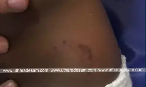 വീട്ടുമുറ്റത്ത് കളിച്ചുകൊണ്ടിരുന്ന 4 വയസുകാരിയെ തെരുവ് നായ്ക്കള് കടിച്ച് പരിക്കേല്പ്പിച്ചു വീട്ടുമുറ്റത്ത് കളിച്ചുകൊണ്ടിരുന്ന 4 വയസുകാരിയെ തെരുവ് നായ്ക്കള് കടിച്ച് പരിക്കേല്പ്പിച്ചു