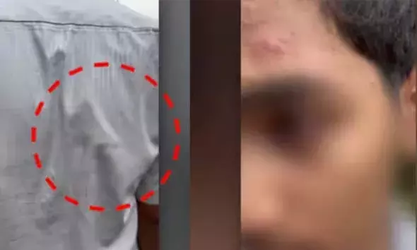 ഷര്‍ട്ടിന് പിറകില്‍ കുത്തിവരച്ചത് ചോദ്യം ചെയ്ത വിദ്യാര്‍ഥിക്ക് സഹപാഠികളുടെ ക്രൂരമര്‍ദനം; 5 പേര്‍ക്കെതിരെ കേസ്