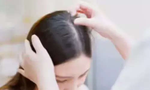 തലമുടി കൊഴിച്ചില് ഉണ്ടോ? അവഗണിക്കരുത്, ചിലപ്പോള് ഈ രോഗങ്ങളുടെ ലക്ഷണങ്ങളാകാം തലമുടി കൊഴിച്ചില് ഉണ്ടോ? അവഗണിക്കരുത്, ചിലപ്പോള് ഈ രോഗങ്ങളുടെ ലക്ഷണങ്ങളാകാം