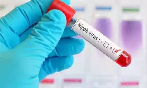 เดชเดพเดฒเดเตเดเดพเดเตเดเต เดจเดฟเดช เดฌเดพเดงเดฟเดคเดฏเตเดเต 10 เดตเดฏเดธเตเดณเตเดณ เดฌเดจเตเดงเตเดตเดฟเดจเตเด เดชเดจเดฟ; เดเตเดเตเดเดฟ เดจเดฟเดฐเตเดเตเดทเดฃเดคเตเดคเดฟเดฒเตโ เดชเดพเดฒเดเตเดเดพเดเตเดเต เดจเดฟเดช เดฌเดพเดงเดฟเดคเดฏเตเดเต 10 เดตเดฏเดธเตเดณเตเดณ เดฌเดจเตเดงเตเดตเดฟเดจเตเด เดชเดจเดฟ; เดเตเดเตเดเดฟ เดจเดฟเดฐเตเดเตเดทเดฃเดคเตเดคเดฟเดฒเตโ