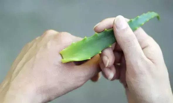 പൊള്ളലേറ്റാല്‍ എന്ത് ചെയ്യും? ഫലപ്രദമായ ചില വീട്ടുവൈദ്യങ്ങള്‍ ഇതാ!