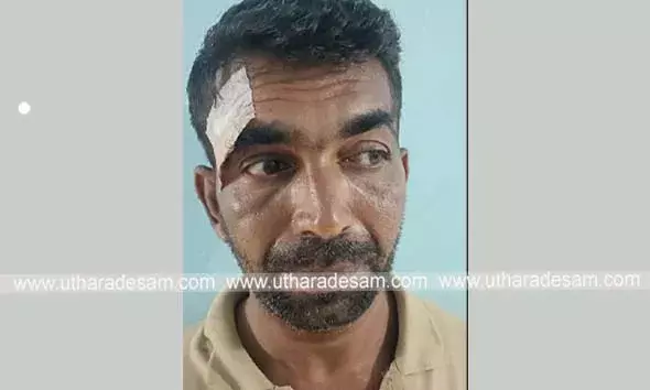 കെട്ടുംക്കല്ലിലെ സൂപ്പര്‍ മാര്‍ക്കറ്റില്‍ നിന്ന് ഫോണ്‍ കവര്‍ന്ന കേസില്‍ പ്രതി അറസ്റ്റില്‍