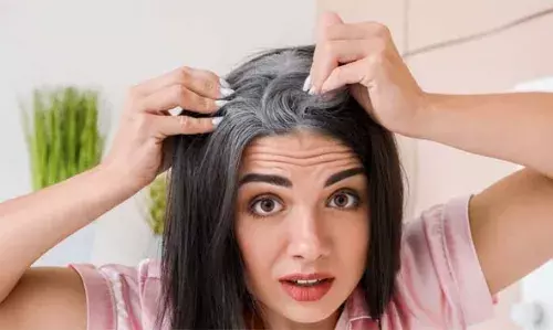 മുടിയുടെ നരയ്ക്ക് സമ്മര്ദ്ദം ഒരു കാരണമാണോ? മുടിയുടെ നരയ്ക്ക് സമ്മര്ദ്ദം ഒരു കാരണമാണോ?