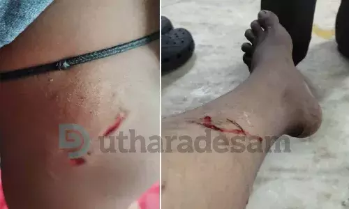 ജില്ലയില് തെരുവുനായ ശല്യം രൂക്ഷമാകുന്നു; ബദിയടുക്കയില് മൂന്ന് വയസ്സുകാരി ഉള്പ്പെടെ ആറ് പേര്ക്ക് കടിയേറ്റു. ജില്ലയില് തെരുവുനായ ശല്യം രൂക്ഷമാകുന്നു; ബദിയടുക്കയില് മൂന്ന് വയസ്സുകാരി ഉള്പ്പെടെ ആറ് പേര്ക്ക് കടിയേറ്റു.