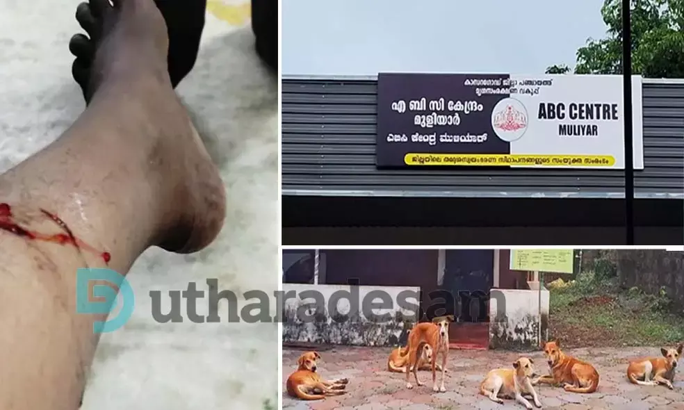 ജില്ലയില്‍ തെരുവുനായ ആക്രമണം കൂടുന്നു; നടപടിയെടുക്കാനാവാതെ എ.ബി.സി സെന്ററിന് അനുമതി കാത്ത് അധികൃതര്‍