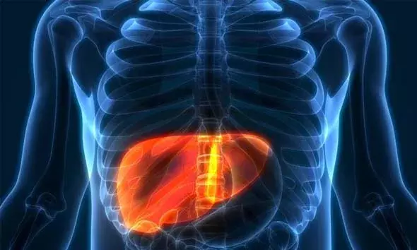 ഈ ലക്ഷണങ്ങള്‍ ഒരിക്കലും അവഗണിക്കരുത്; ലിവര്‍ ക്യാന്‍സറിന്റെ സാധ്യതയാകാം