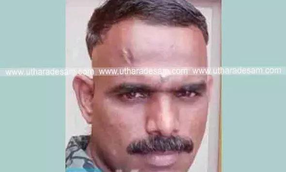 കുമ്പള ഭാസ്‌ക്കര്‍ നഗറില്‍ നിയന്ത്രണം വിട്ട കാര്‍ കലുങ്കിലിടിച്ച് പരിക്കേറ്റ ടയര്‍ഷോപ്പ് ജീവനക്കാരന്‍ മരിച്ചു