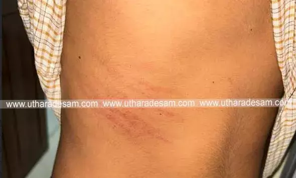 കുമ്പള സ്‌കൂളില്‍ സംഘട്ടനം പതിവാകുന്നു; രണ്ട് വിദ്യാര്‍ത്ഥികളെ പുറത്തുനിന്നും വന്നവര്‍ മര്‍ദ്ദിച്ചു