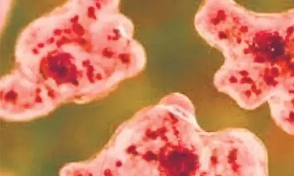 സംസ്ഥാനത്ത് അമീബിക് മസ്തിഷ്‌ക ജ്വരം ബാധിച്ച് ഒരാള്‍ കൂടി മരിച്ചു