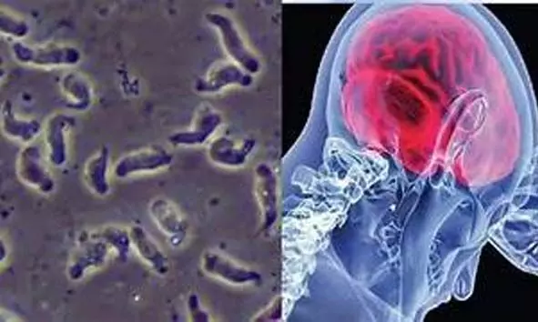 വീണ്ടും ഒരു മരണം കൂടി: അമീബിക് മസ്തിഷ്‌ക ജ്വരം ബാധിച്ച് ചികിത്സയിലായിരുന്ന 26കാരി മരിച്ചു