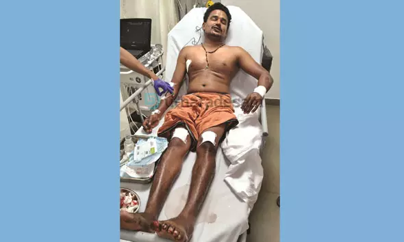 കാട്ടുപന്നി ശല്യം രൂക്ഷം; ബൈക്ക് യാത്രികന് പരിക്കേറ്റു