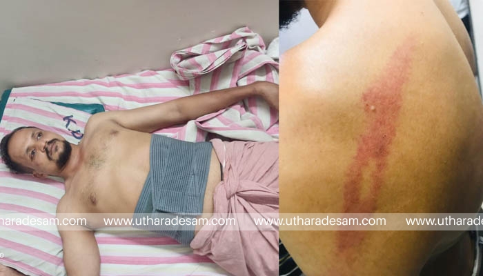 അടുക്ക വീരനഗറില്‍ പൊലീസിനെയും നാട്ടുകാരെയും വെല്ലുവിളിച്ച് ഗുണ്ടാവിളയാട്ടം; ബസ് ഉടമയെ മാരകായുധങ്ങളുമായി അക്രമിച്ചു