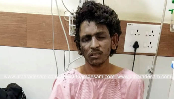 മംഗളൂരു കുക്കര്‍ ബോംബ് സ്‌ഫോടനക്കേസില്‍ എന്‍.ഐ.എ അന്വേഷണം കേരളത്തിലേക്കും; പൊള്ളലേറ്റ മുഖ്യപ്രതിയെ പൊലീസ് ആസ്പത്രിയില്‍ വെച്ച് ചോദ്യം ചെയ്തു